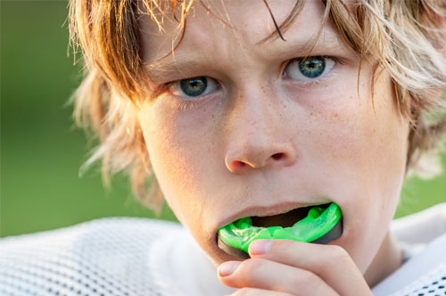 Athletic Mouthguards Are the Right Play