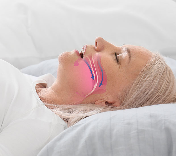 Rancho Cucamonga Dentist